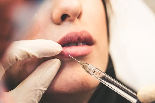 A woman having lip injections done to her lips.