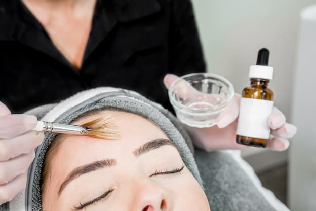 Chemical Peel Vs Microneedling: Which Is Best For Your Skin?