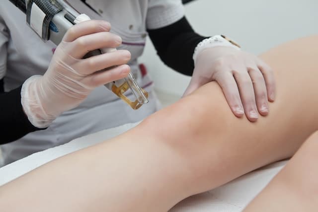 A woman having laser hair removal done on her legs.