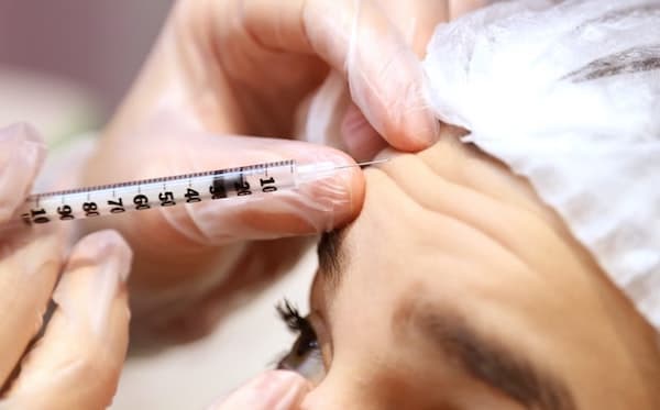 A woman getting botox in her forehead.