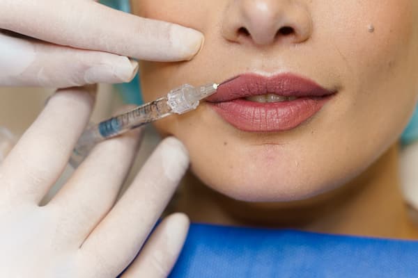 A woman having lip fillers injected into her lips.