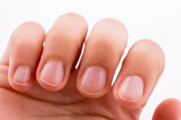 A woman's nails with no nail polish.